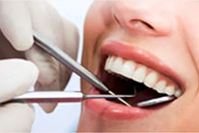 Dental Scaling / Prophylaxis Cleaning