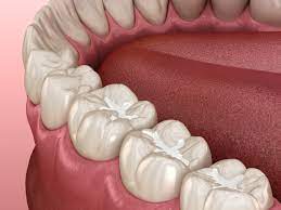 Preventive Dental Care